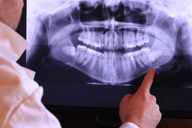 Best Emergency Tooth Extraction in Gravette, AR